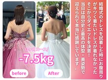 ハレ(HARE)/ブライダル実績（痩身/整体）