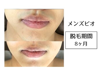 メンズビオ 神戸三宮店/