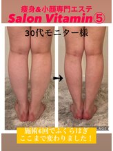 サロン ビタミンファイブ(Salon Vitamin5)/足の浮腫みも改善ヽ(^o^)