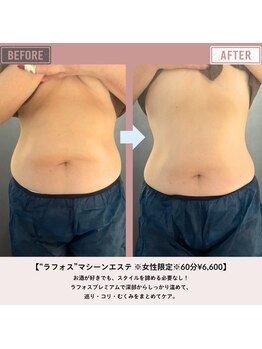 マーリエ(Malie)/【ラフォス】腹部集中！