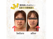 見た目から内側まで、沢山の嬉しい変化を是非楽しんで下さい★