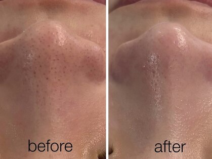 リスポアラボ(LIS PORE.LAB)の写真