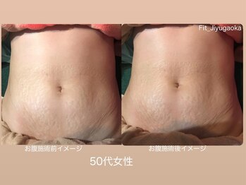 フィットジユウガオカ(Fit_Jiyugaoka)/おなか痩/身へのサポート施術