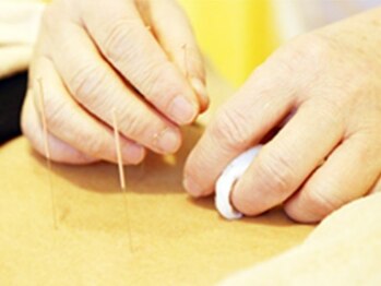 こらんこらん鍼灸院の写真/あなただけのオーダーメイド施術♪首や肩など全身の不調を改善◎鍼施術で眼精疲労・頭痛もスッキリ★