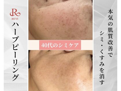 ククル(KUKULU)の写真