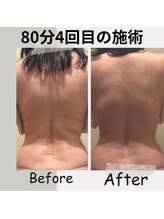 ソワンドメイ 四谷(SOIN DE MEI)/インディバダイエットモニター