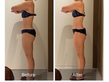 ルナスーリヤ 仙台店/セルドライブプロ☆下半身