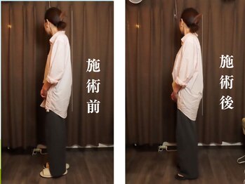 成心整体院/江東区の成心整体院 ★姿勢矯正