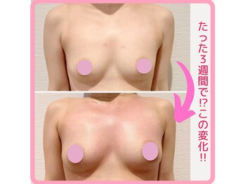 アーレ 福岡天神店(ARE)