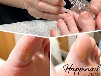 ハピネイル(Happinail)の写真/全コースでフットバス付♪ケア特化&爪悩み解消サロンでがさがさかかと&匂い対策◎巻き爪矯正やむしり対策も