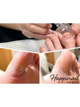 角質ケアができるサロン