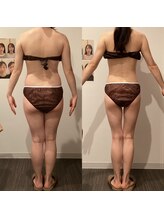 イロドリ 南浦和(irodori)/産後骨盤矯正Before＆After