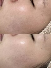 フェリノ(FERINO)/ホームケア&サロンケアの成果