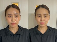 ヨサパーク リアン(YOSA PARK Lien)/before（左）→after（右）