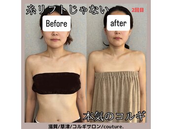 クチュール(couture.)/2回目after