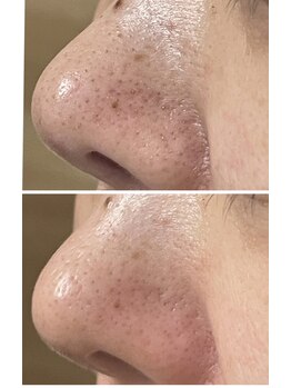 プラム(plum)/たった1回でもこの効果♪