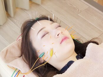 ハリナチュレ 札幌店/ブライダル【美容鍼/小顔矯正】