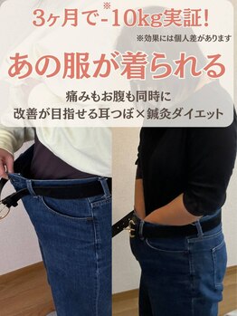 やくわ新坂町はり灸マッサージ治療院の写真/去年の服、諦めてませんか？痛みもお腹もガマン無しで同時に変わる【耳つぼ×鍼灸】
