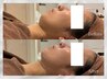 【ブライダル】【FACIAL】肌質ケア+小顔+艶肌仕上げ 120分