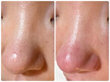 サイセイ(SAISEI)/ハイレベル洗浄！