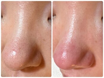 サイセイ(SAISEI)/ハイレベル洗浄!