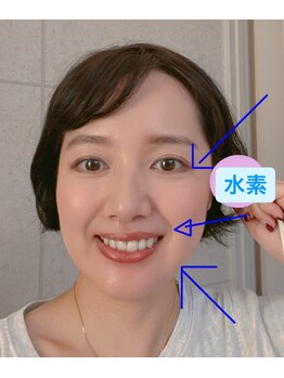 ヨサパーク ペチュニア 世田谷店(YOSA PARK Petunia)/水素吸入なら2秒でリフトアップ