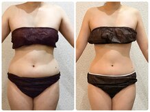 ウェリナ平和堂長久手院/小顔矯正/骨盤矯正/痩身/整体