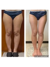 ビボディラボ 海老名店(美Body Labo)/セル脂肪