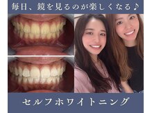 グリッター ショウナン(glitter.SHONAN)の雰囲気（歯が白いと笑顔が増える◎）
