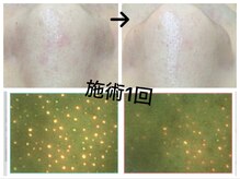 ベベ クロス ディディア 北見店(Bebe×DiDiA)