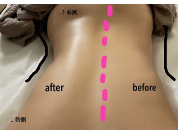 ラグナブルー(Laguna blue)/全身リンパで身体のラインが変化