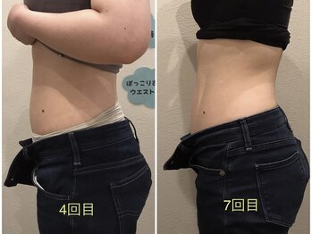 柏の葉オレンジ整体院/【変化】