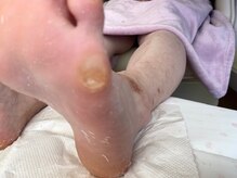 ビサンテ サロン/魚の目＆たこは名古屋・ビサンテ