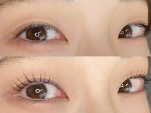 リトマス(LITMUS)/やらない理由なくない？