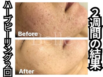 ベル 心斎橋店(Belle)/フルオプションの効果