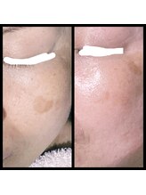 ココスタイルビューティー(COCOSTYLE beauty)/