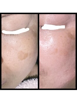 ココスタイルビューティー(COCOSTYLE beauty)/