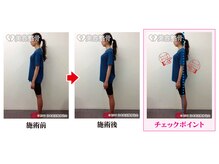 エミット(emit.)/骨盤整体