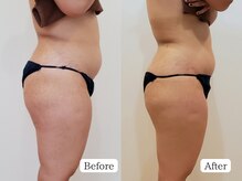 至空院/リンパ＋α