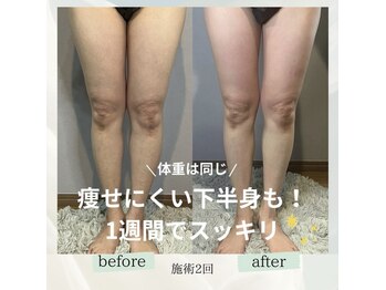 エネイブル(ENable)/