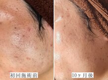 ユウビジン(YOU美人)/