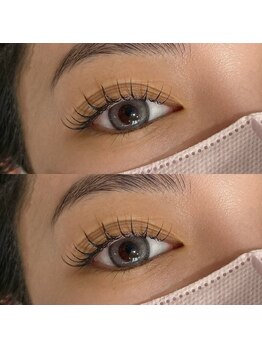 ファクト(FACT?)/フラットラッシュ140