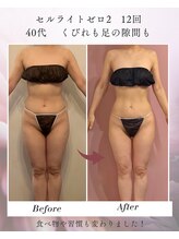 ティーサロン 石神井公園店(T SALON)/