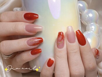 定額/フィルイン/パラジェル