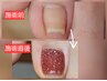 【巻き爪用フットジェル】ワンカラー＋巻き爪補正専用ジェル（親指）