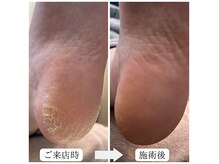 ケアリ(CAREri)の雰囲気(【大人気!】足裏角質かかとケアでしっとりスベスベ赤ちゃん足に)
