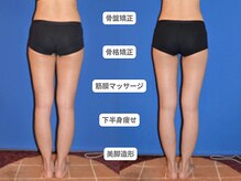 ピュアノア 垂水店/痩身人気No.2【骨格・姿勢矯正】