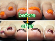 チピネイル 尼崎(chipinail)の雰囲気（巻き爪でお悩みの方！サンダル履きたいなら今からでも間に合う！）