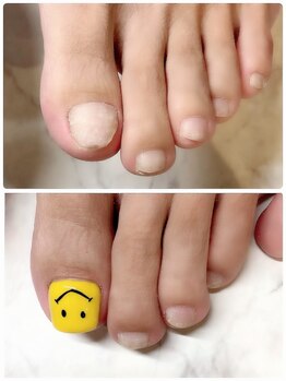 アムール(amour)/