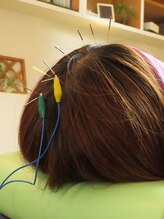 薄桜樹/睡眠の質を高めるおねむり鍼